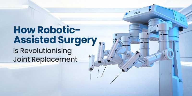 Benefits of Robotic-Assisted Joint Replacement Surgery