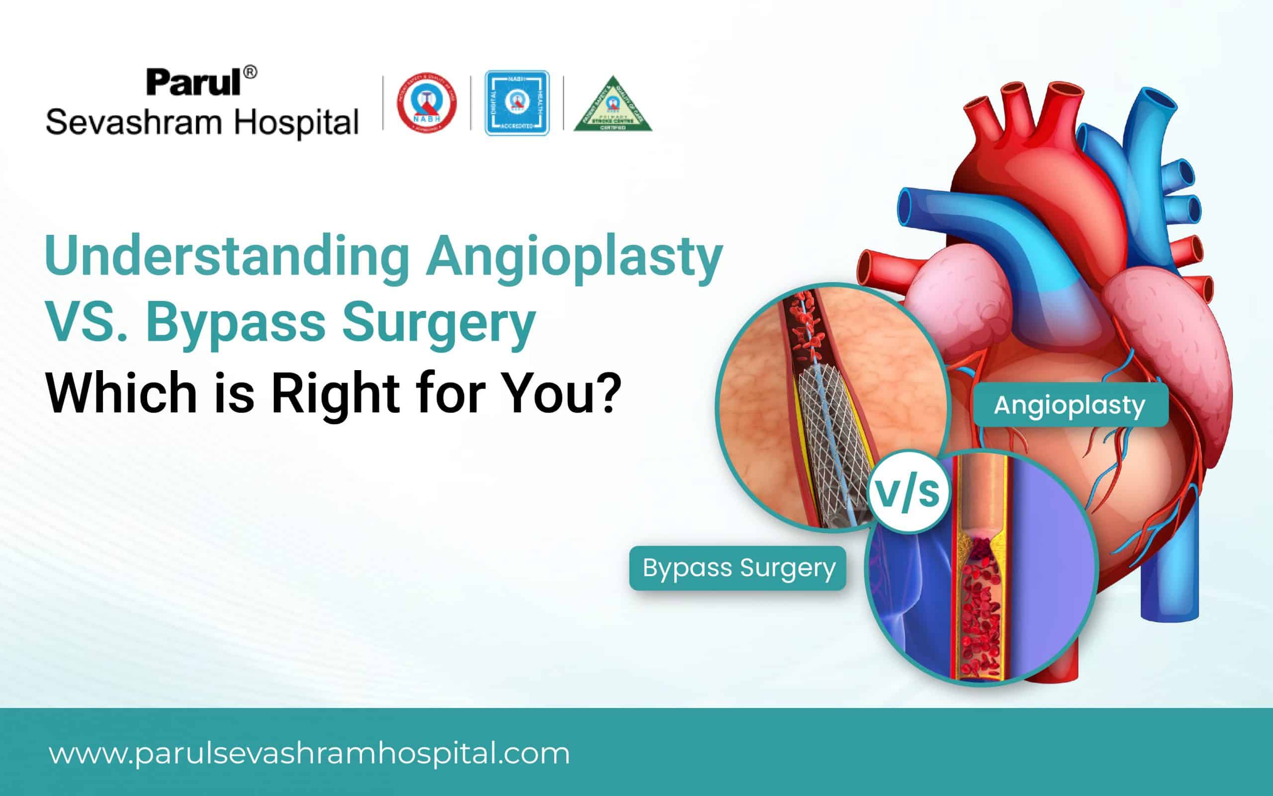 angioplasty vs bypass surgery
