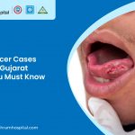 oral cancer treatment