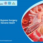 Bypass Surgery in Vadodara