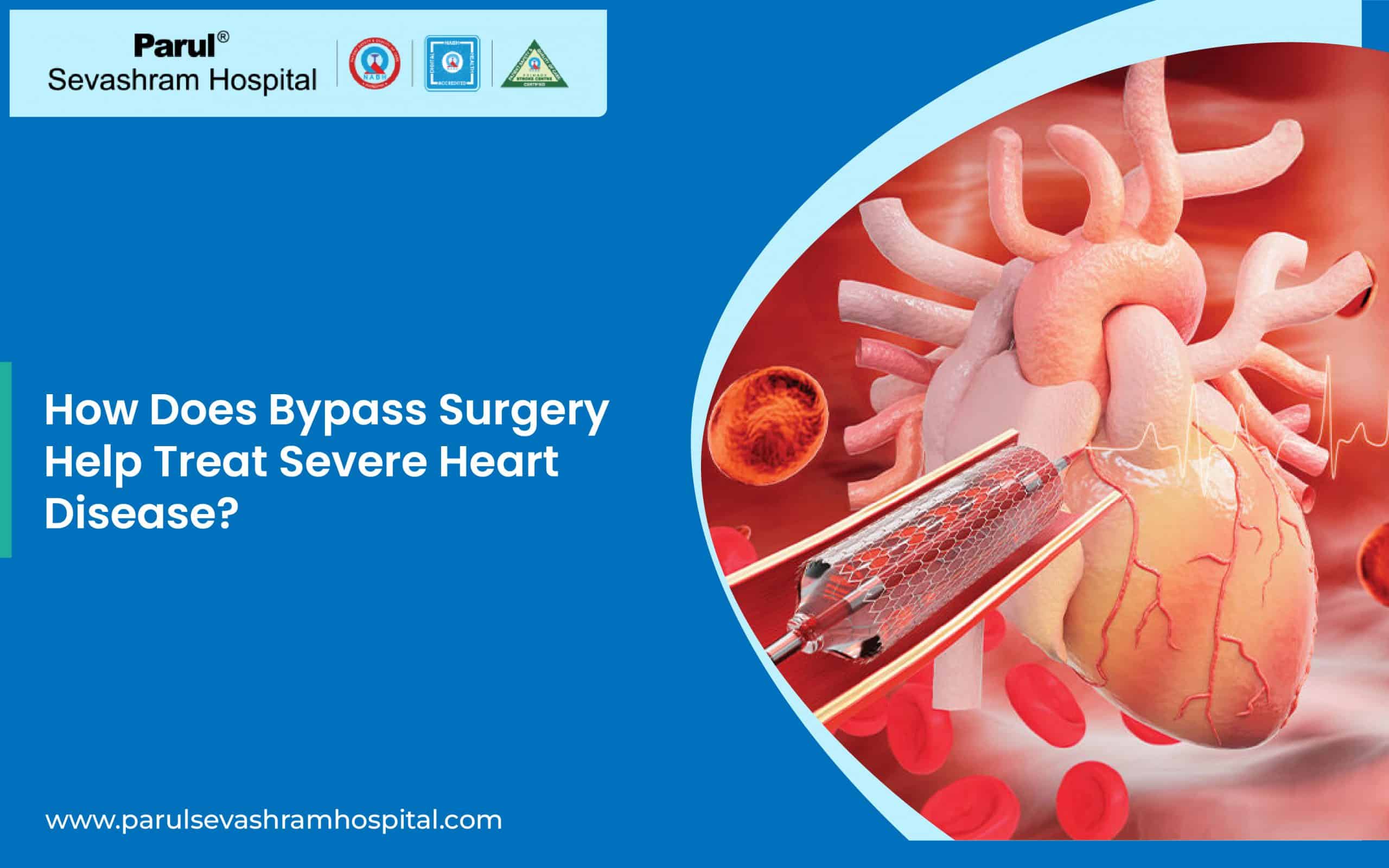 Bypass Surgery in Vadodara