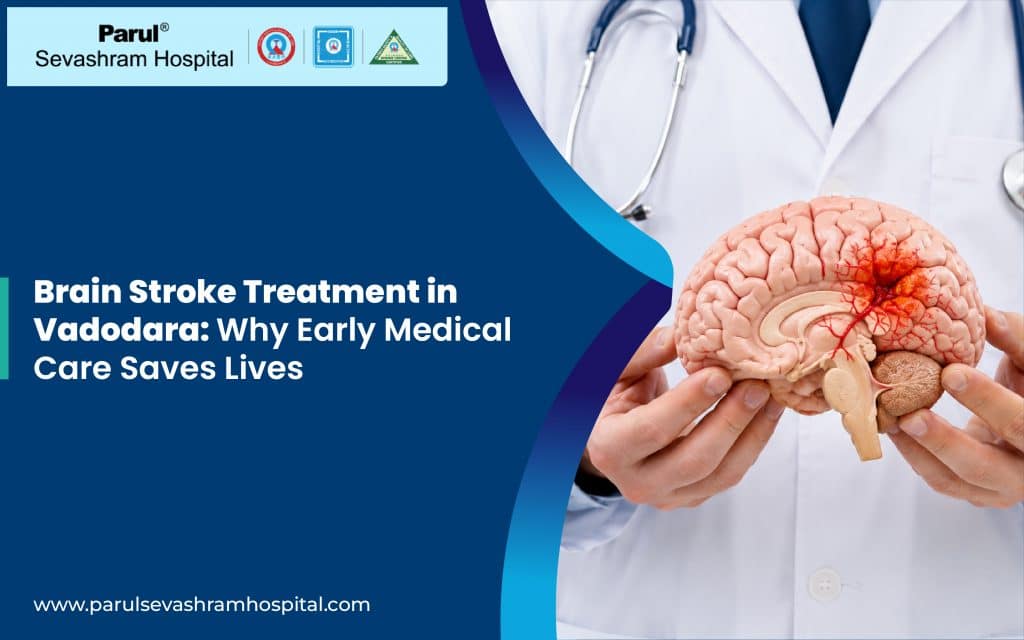 brain stroke treatment in Vadodara