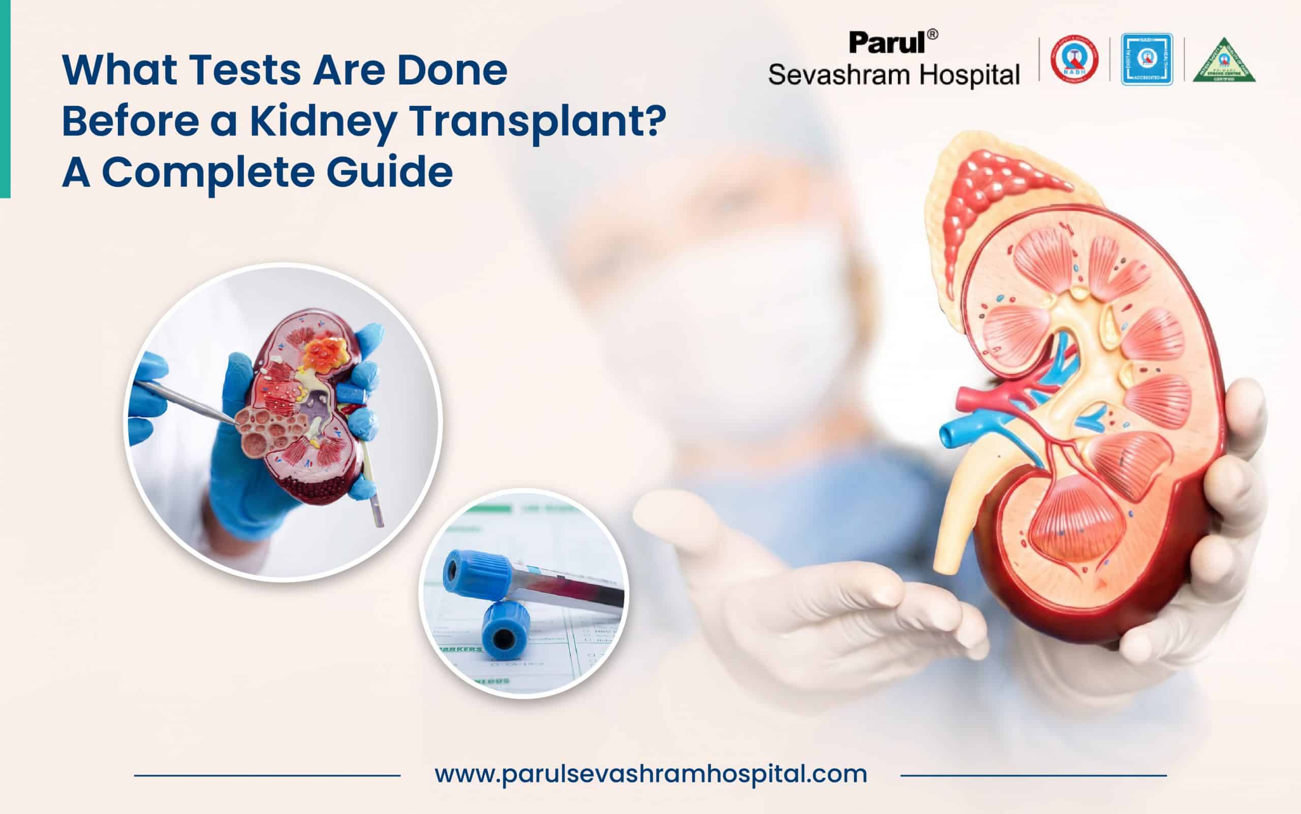 kidney transplant surgery in Vadodara